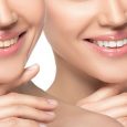 3 Teeth Whitening Tips To Achieve Maximum Results